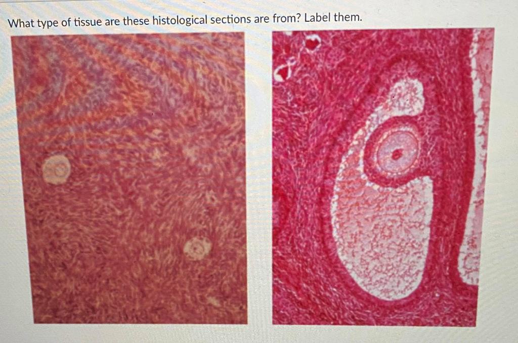 Solved What type of tissue are these histological sections | Chegg.com