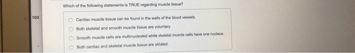 Solved Which Of The Following Statements Is TRUE Regarding Chegg