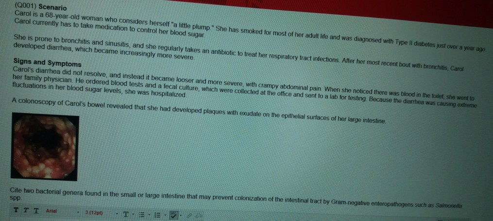Solved (Q001) Scenario Carol is a 68-year-old woman who | Chegg.com