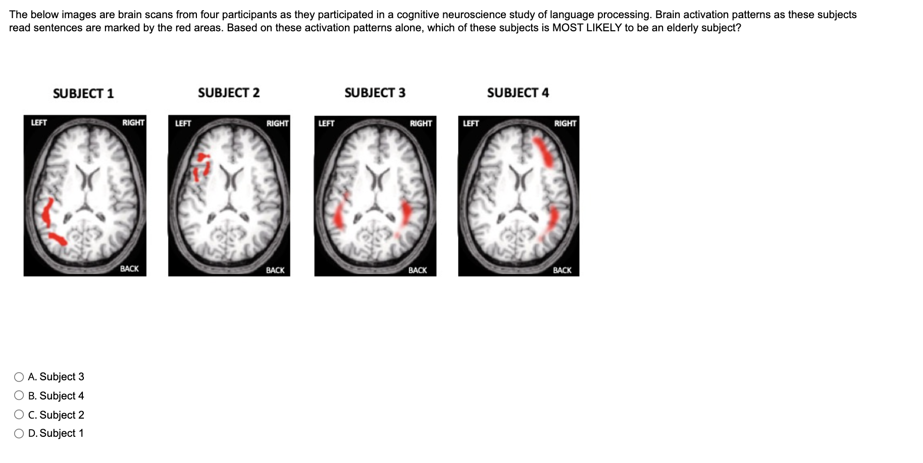 Solved The below images are brain scans from four | Chegg.com