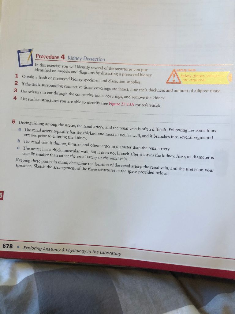 Solved Procedure 4 Kidney Dissection In this exercise you