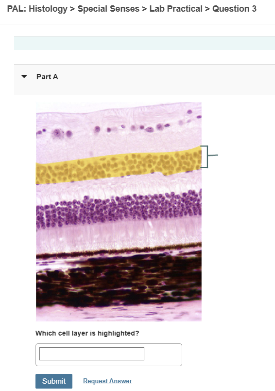 Solved PAL: Histology &gt; ﻿Special Senses &gt; ﻿Lab Practical &gt; | Chegg.com