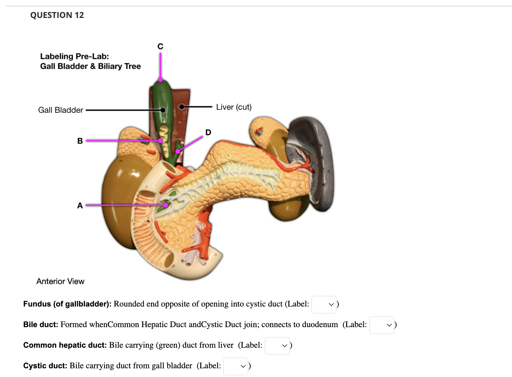 Solved Labeling Pre-Lab: Large Intestine J Anterior View | Chegg.com