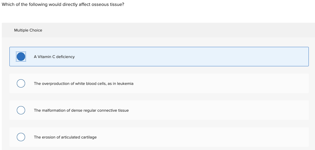 Solved Which of the following would directly affect osseous | Chegg.com
