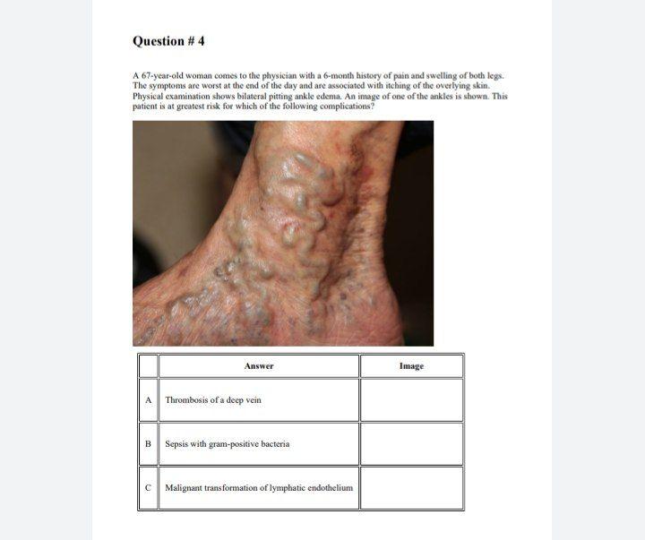 A) A 67-year-old woman represented varicose veins as well as edema