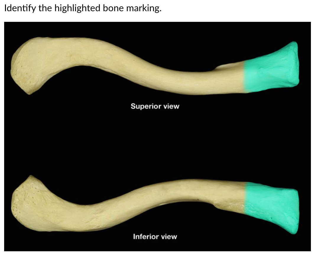 Solved Identify the highlighted bone marking. Superior view | Chegg.com