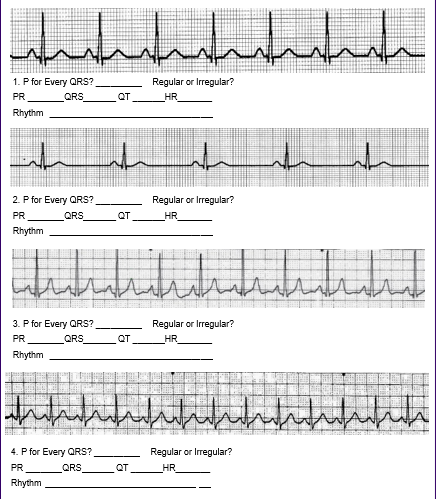 Solved سلام امام مرام 1. P for Every QRS? PR _QRS Rhythm | Chegg.com