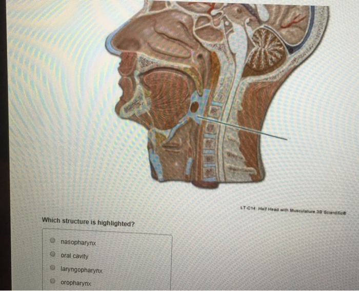 solved-which-structure-is-highlighted-o-jejununm-o-large-chegg