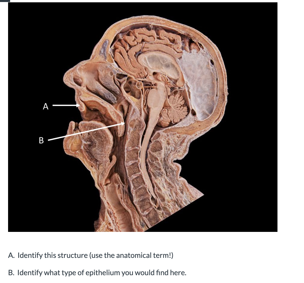 Solved A. Identify this structure (use the anatomical term!) | Chegg.com