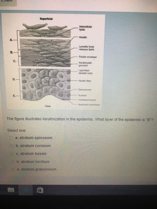 Solved The figure illustrates keratinization in the | Chegg.com