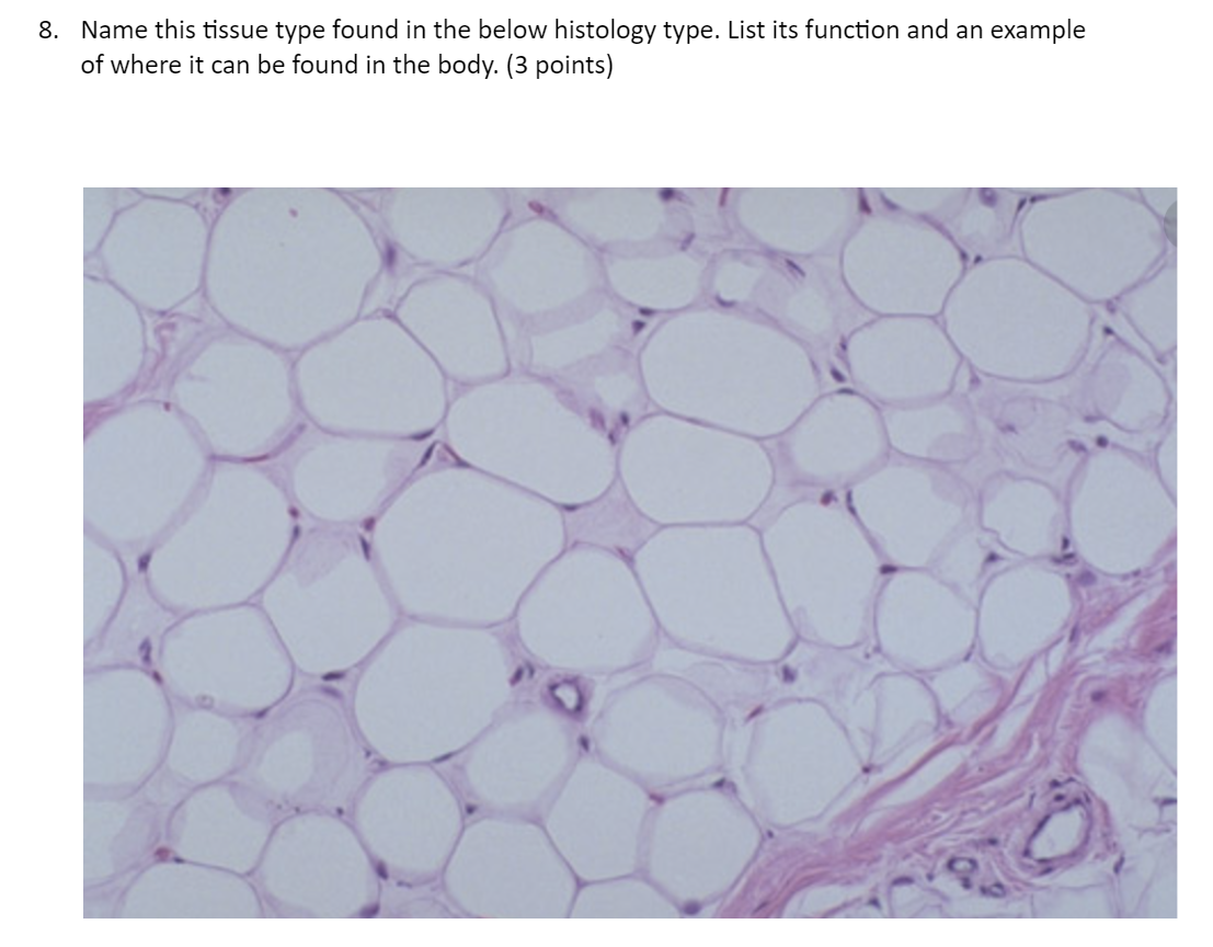 Solved 5. Name this tissue type found in the below histology | Chegg.com