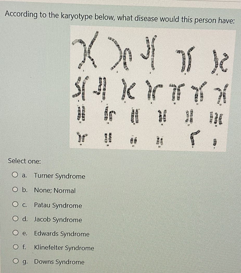 Solved According to the karyotype below, what disease would | Chegg.com