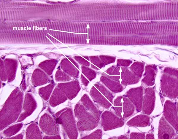 Solved Skeletal Muscle Cells Drawing Label: nuclei and | Chegg.com