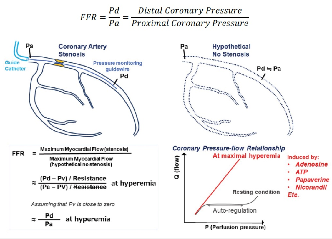 solved-the-fractional-flow-reserve-ffr-is-a-ratio-of-the-chegg