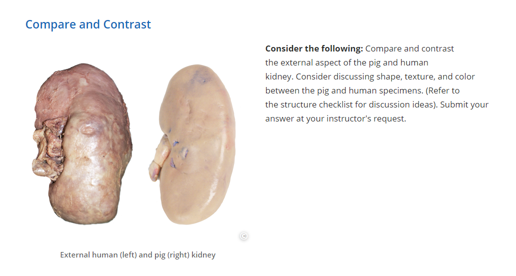 Solved Compare And Contrast Consider The Following Compare Chegg