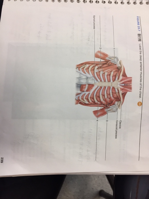 Solved Label the deep anterior muscles of the chest.