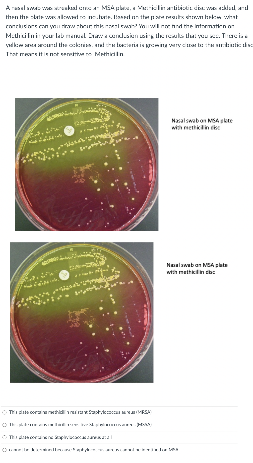 Solved A nasal swab was streaked onto an MSA plate, a | Chegg.com