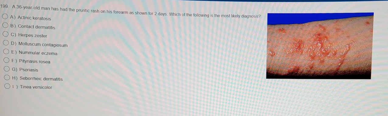199. A 36-year-old man has had the pruritic rash on his forearm as shown for 2 days. Which of the following is the most likel