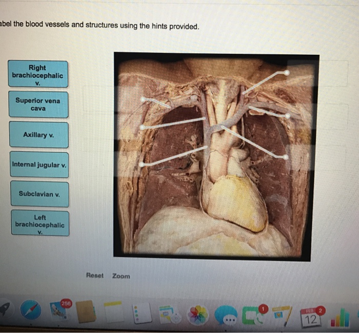 Solved Label The blood vessels and structures using the