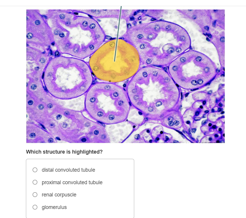 Solved Which structure is highlighted? distal convoluted | Chegg.com