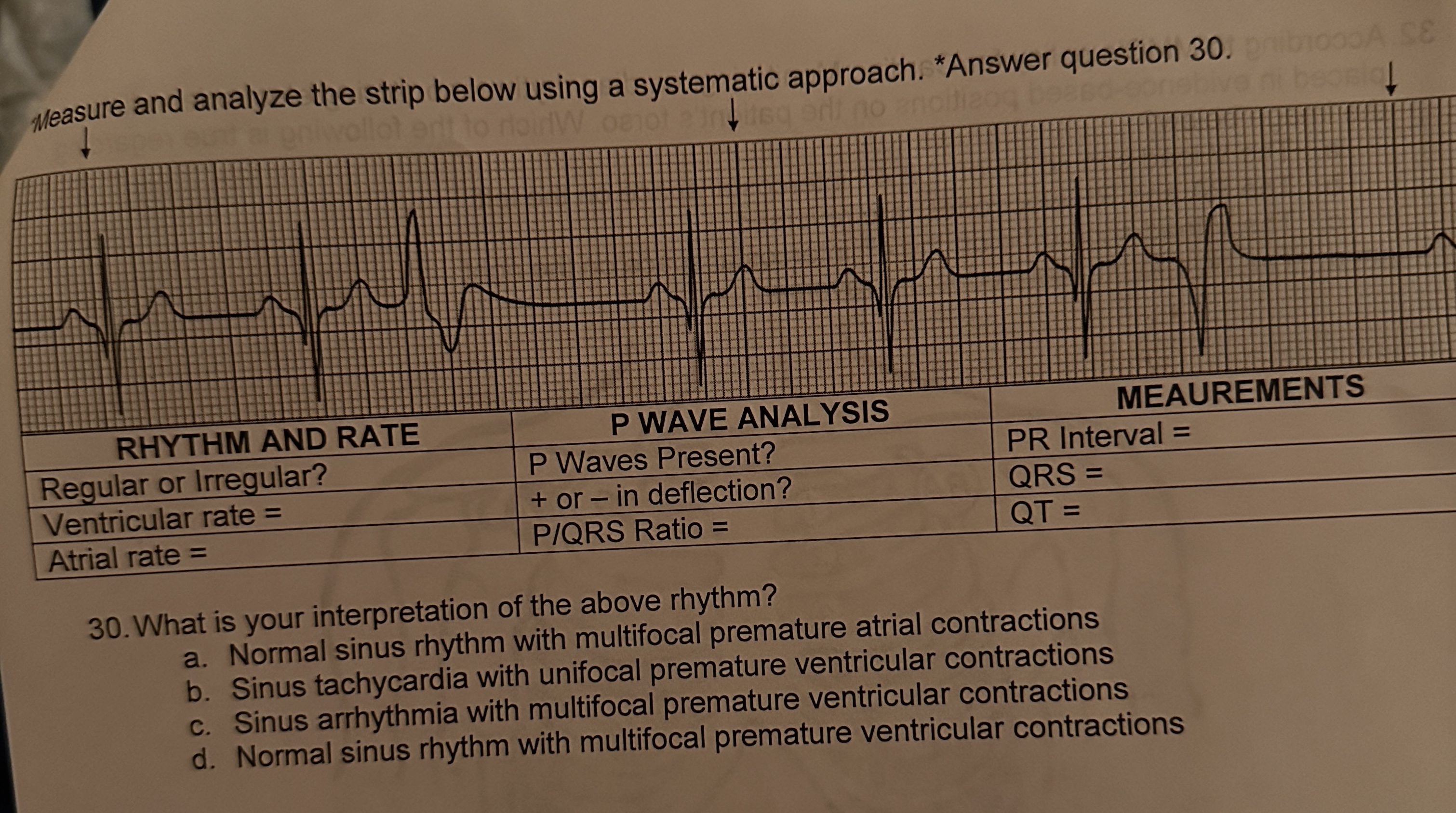 Premature Atrial Contraction Strip