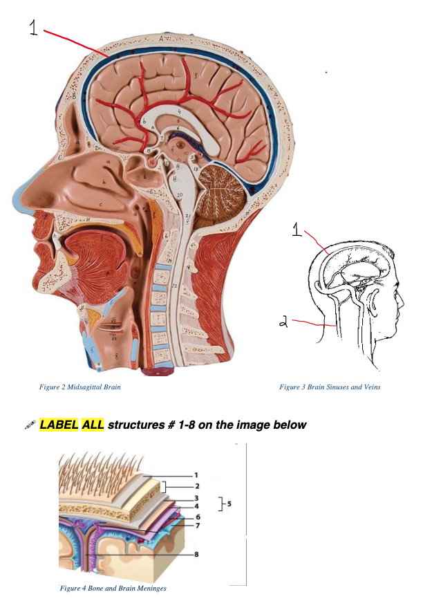 Solved LABEL the ventricular system on this image 1 .2 2 3 | Chegg.com
