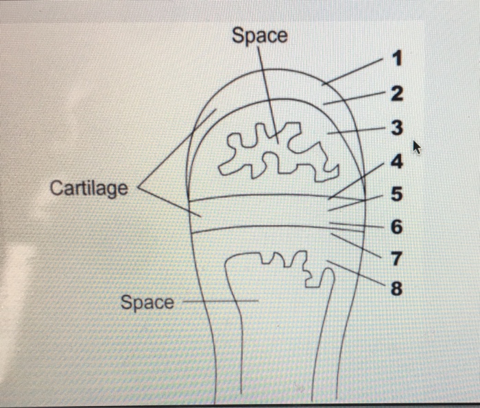Solved in longitudinal growth of a long bone. 5 steps occur | Chegg.com