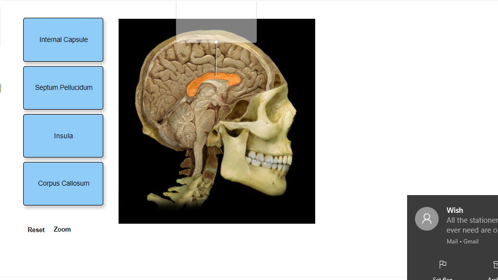 Solved Internal Capsule Septum Pellucidum Insula Corpus | Chegg.com