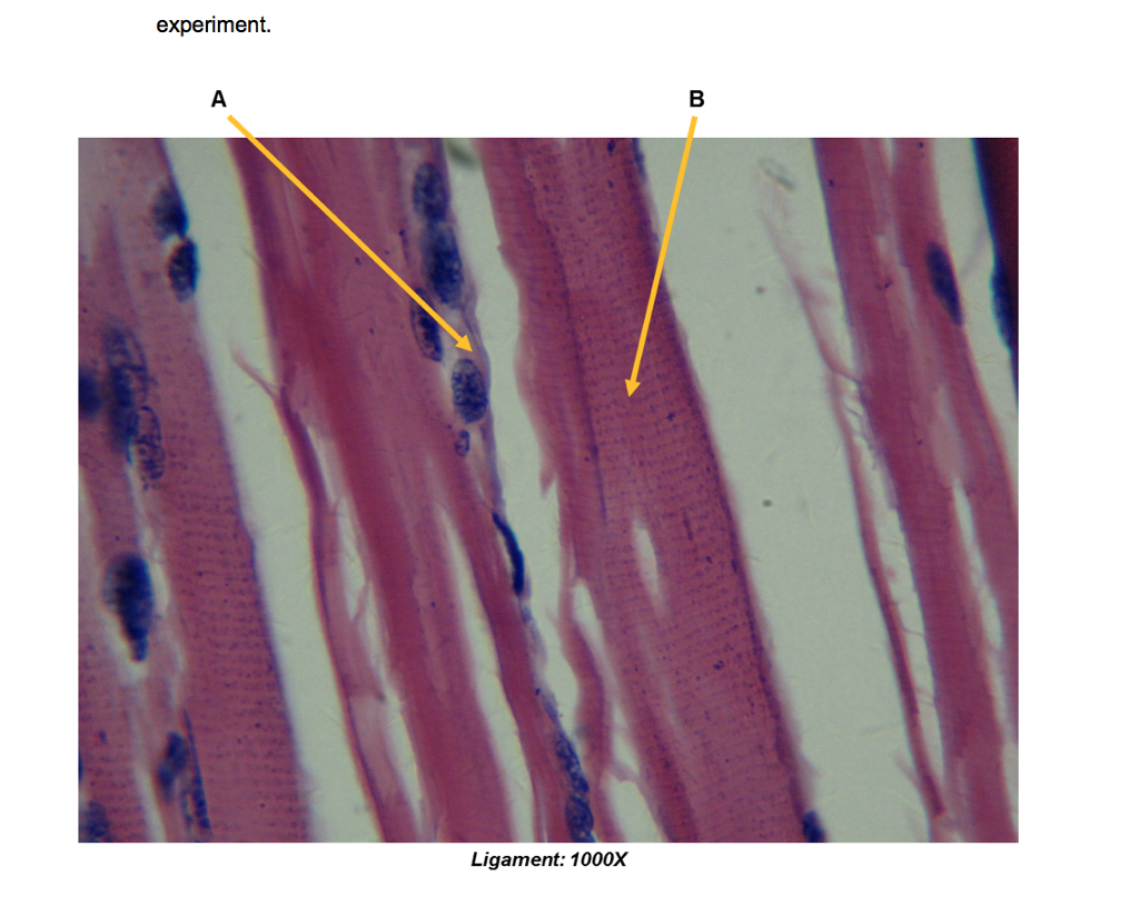 experiment. Tendon-Muscle Insertion: 100X | Chegg.com