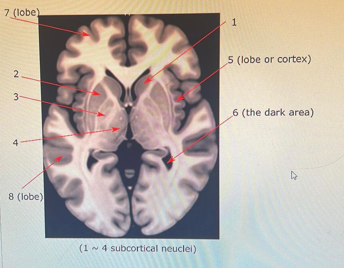 Solved 5 (lobe or cortex) 6 (the dark area) | Chegg.com