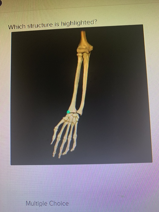 Solved Which structure is highlighted? Multiple Choice