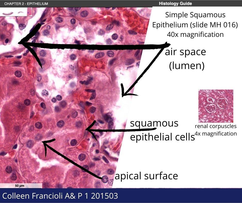 Simple Squamous Epithelium Slide Labeled
