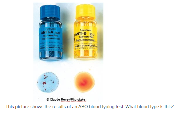 Solved A) A B) B C) O D) AB E) Either A Or B, Not Enough | Chegg.com