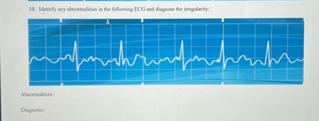 Solved Identify Any Abnormalities In The Following ECG And | Chegg.com