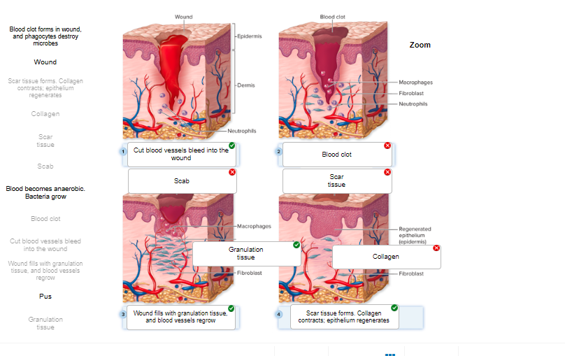 Solved Key Concept Activity: Wound HealingPlease label the | Chegg.com