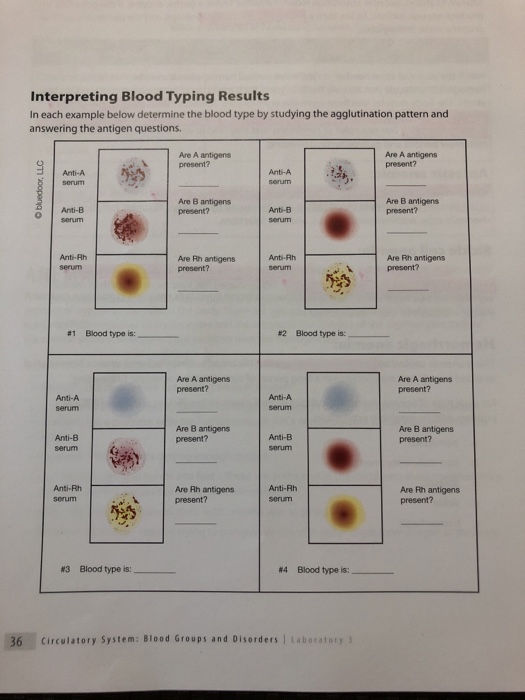 Solved Interpreting Blood Typing Results In Each Example | Chegg.com