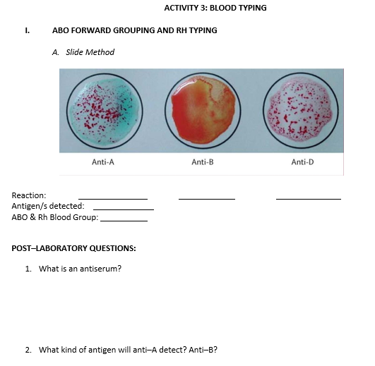 Solved ACTIVITY 3: BLOOD TYPING I. ABO FORWARD GROUPING AND | Chegg.com