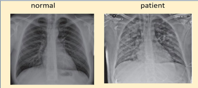 Solved A 56-year-old woman presented in an emergency ward | Chegg.com