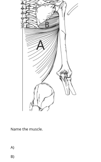 Solved A Name The Muscle. A) B) | Chegg.com