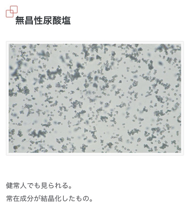 国試 検査総論 尿沈渣 Flashcards Chegg Com