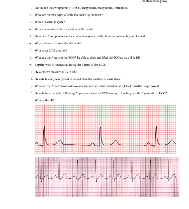 Solved Electrocardiogram L. Define The Following Terms (4): | Chegg.com