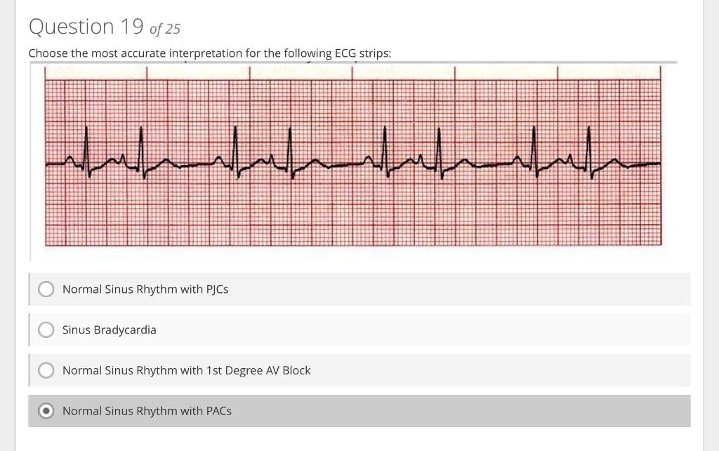 Choose the most accurate interpretation for the following ECG strins:
Normal Sinus Rhythm with PJCs
Sinus Bradycardia
Normal 