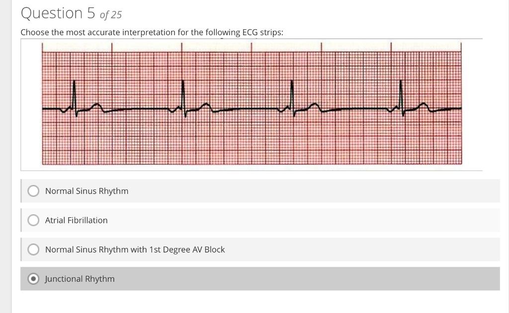 Choose the most accurate interpretation for the following ECG strips:
Normal Sinus Rhythm
Atrial Fibrillation
Normal Sinus Rh