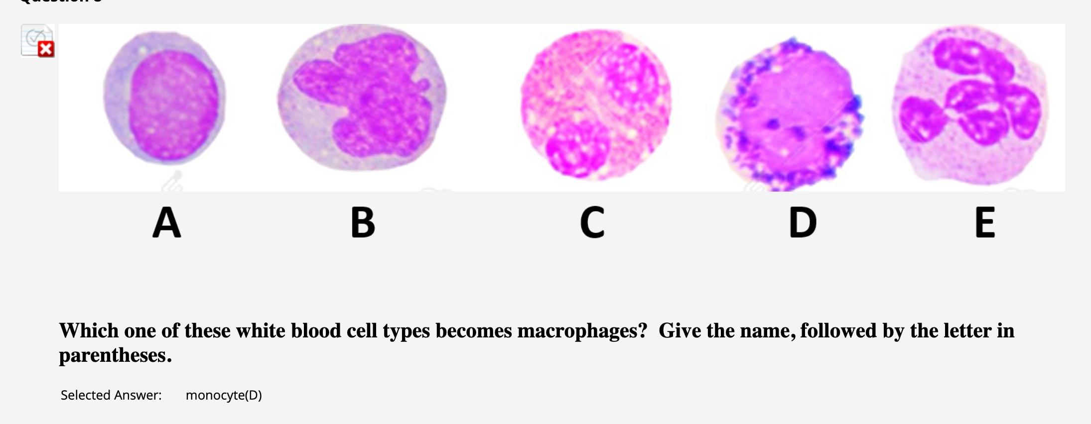 solved-which-one-of-these-white-blood-cell-types-becomes-chegg