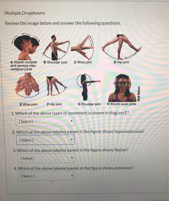 Solved Which type of joint permits this type of movement? 1.