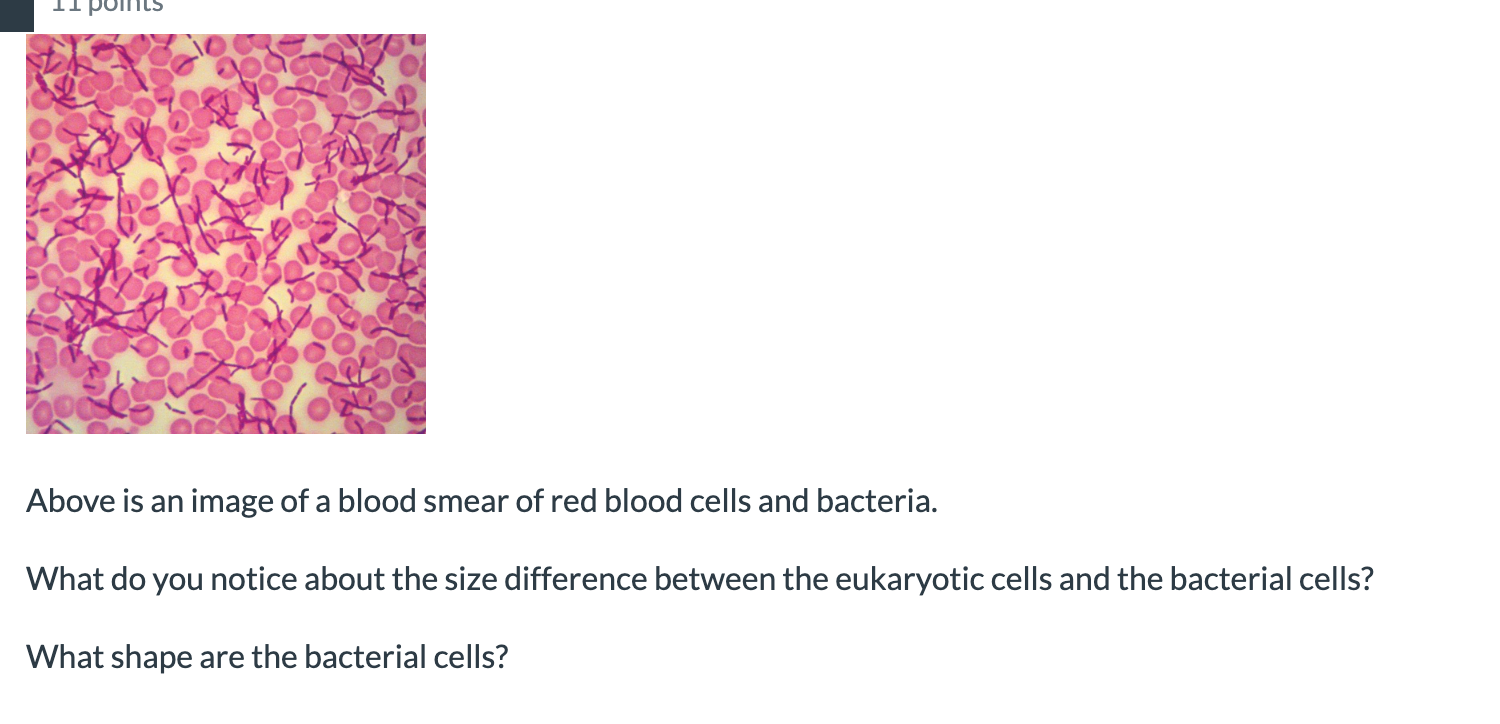 Above is an image of a blood smear of red blood cells | Chegg.com