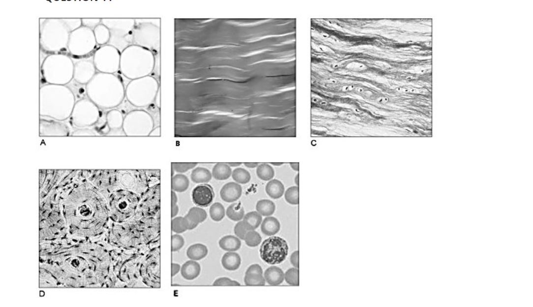 Provides Tensile Strength With The Ability To Absorb Compressive Shock www.chegg.com