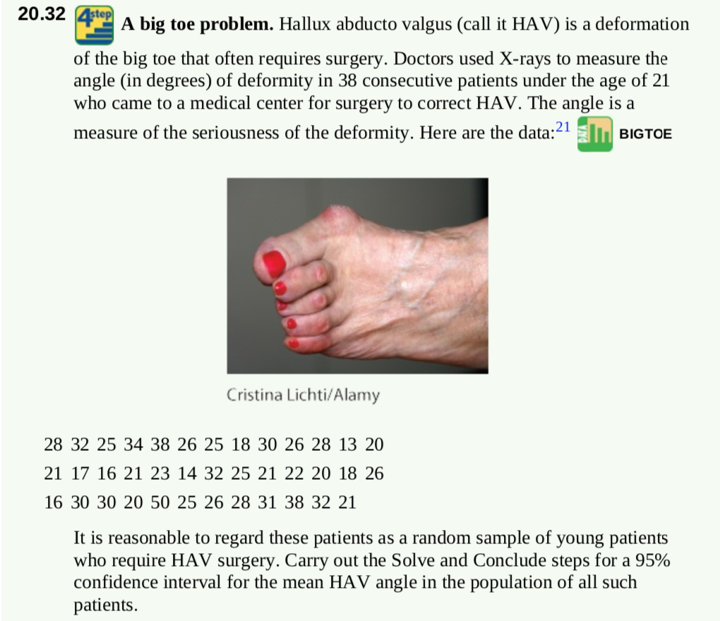 Solved step 20.32 A big toe problem. Hallux abducto valgus | Chegg.com