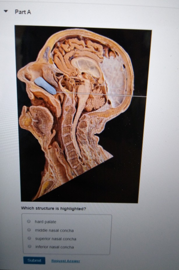 Solved: Respiratory System > Quiz > Question Which Structu... | Chegg.com