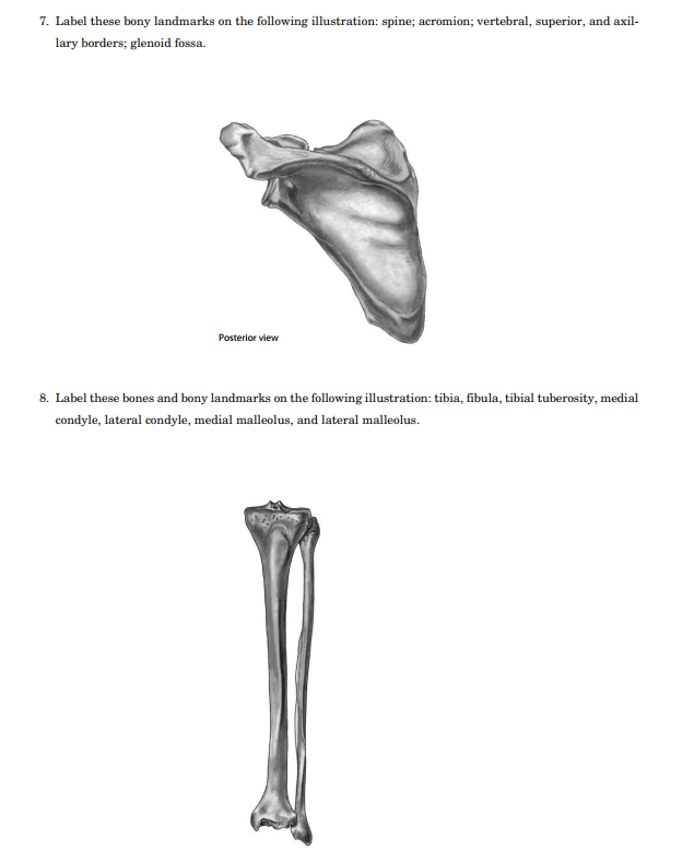 solved-4-consider-the-muscle-markings-on-the-humerus-chegg